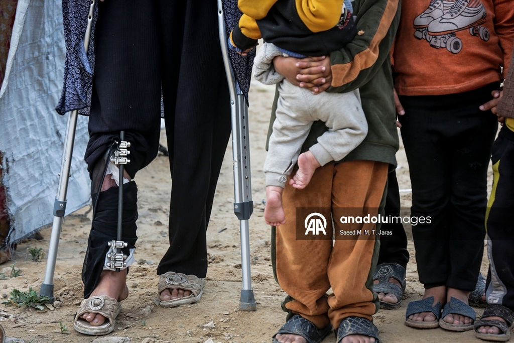 İsrail saldırısında ağır yaralanan Filistinli anne tedavi olmayı bekliyor