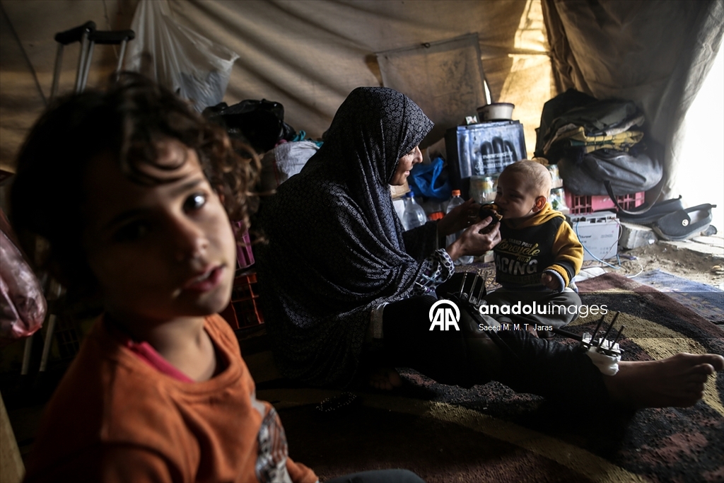 İsrail saldırısında ağır yaralanan Filistinli anne tedavi olmayı bekliyor