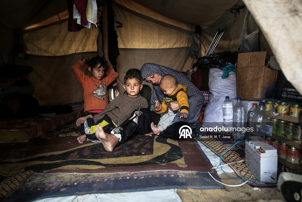 İsrail saldırısında ağır yaralanan Filistinli anne tedavi olmayı bekliyor