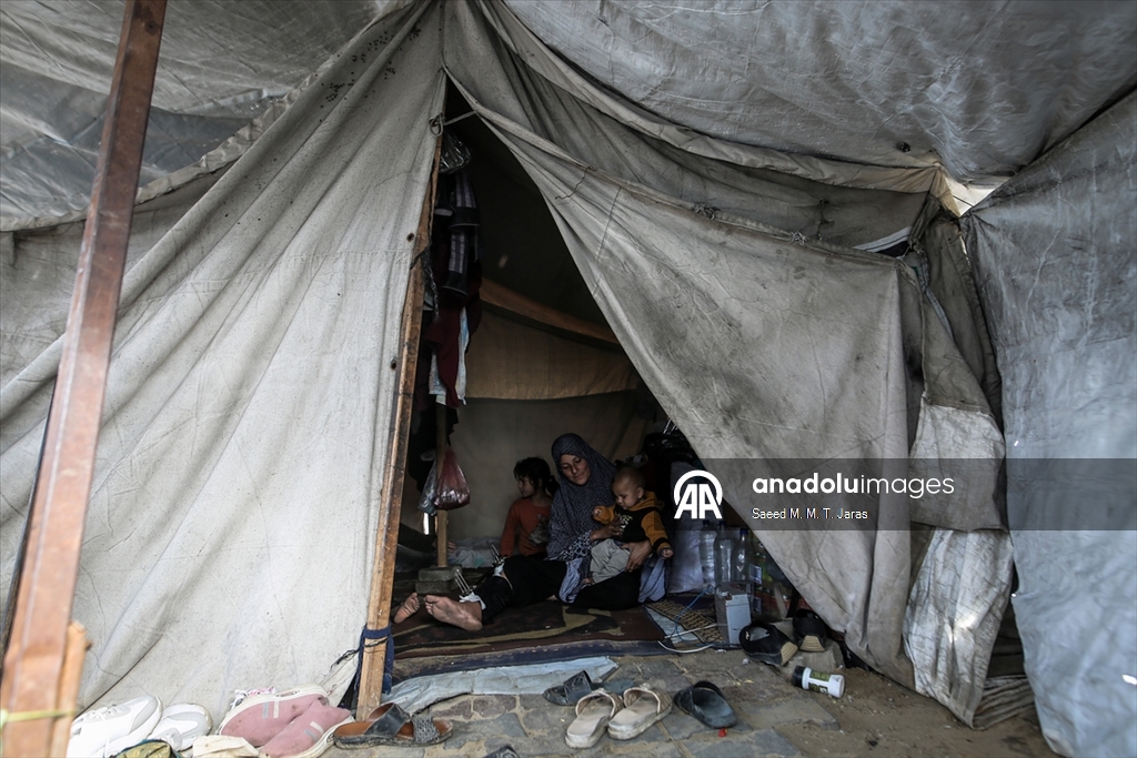 İsrail saldırısında ağır yaralanan Filistinli anne tedavi olmayı bekliyor