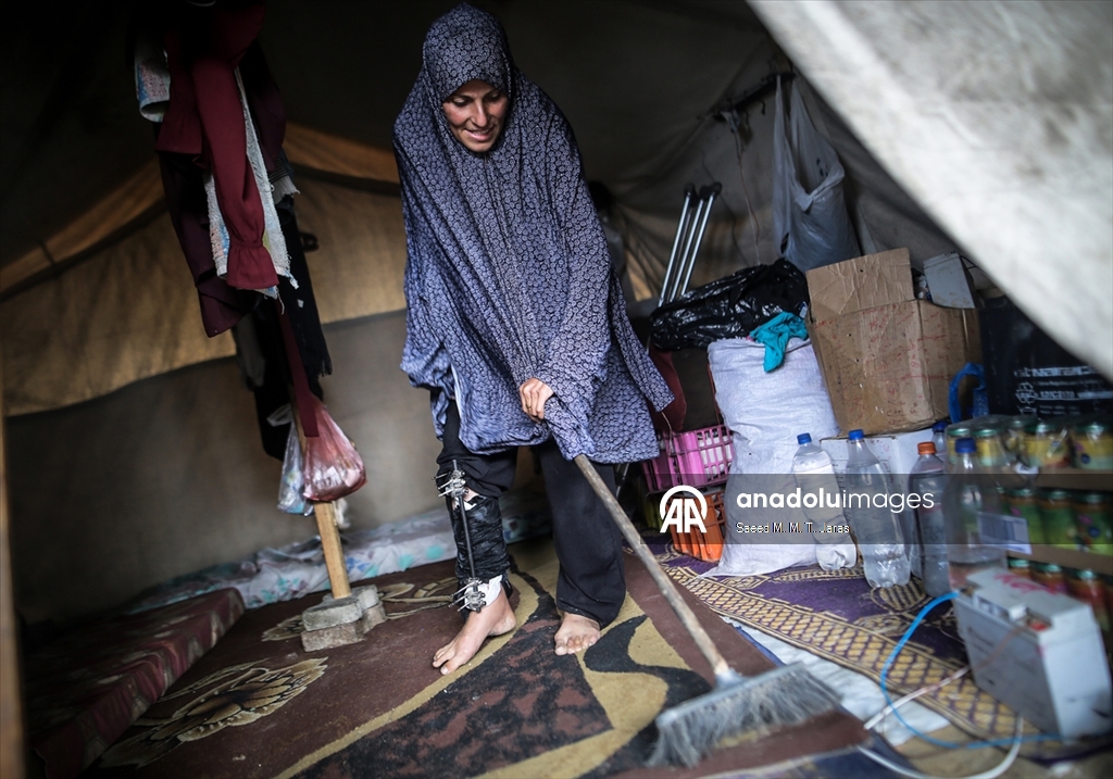 İsrail saldırısında ağır yaralanan Filistinli anne tedavi olmayı bekliyor