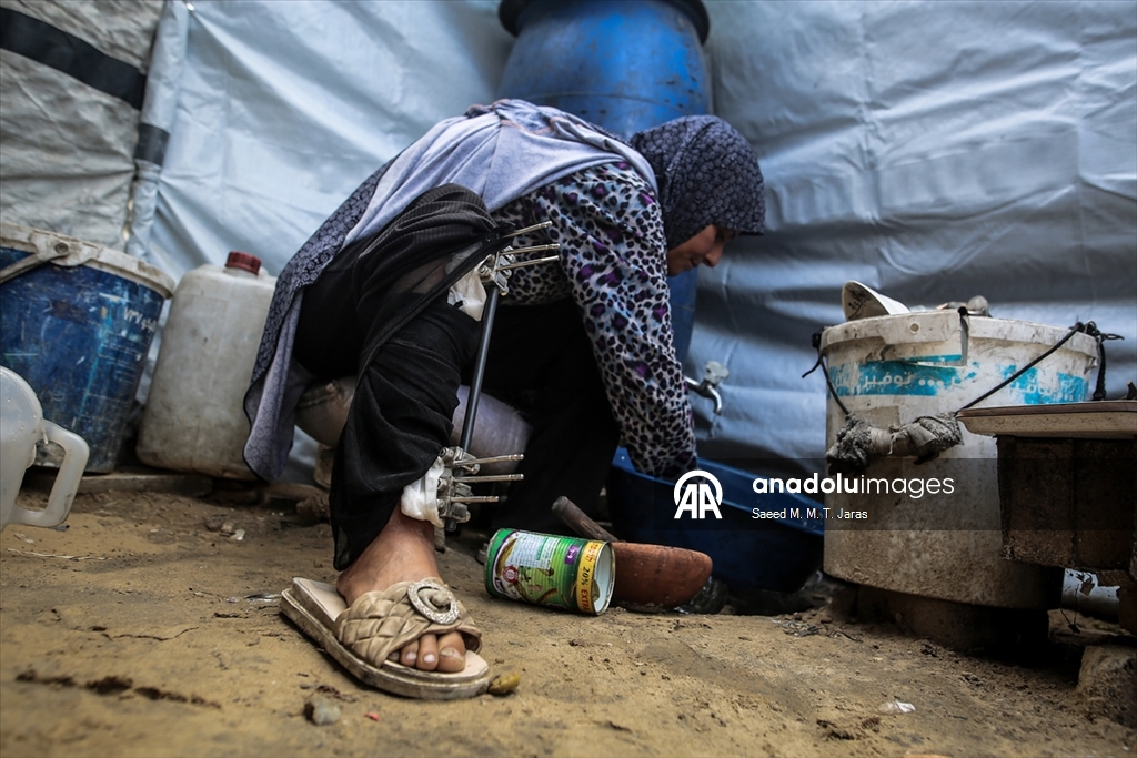 İsrail saldırısında ağır yaralanan Filistinli anne tedavi olmayı bekliyor