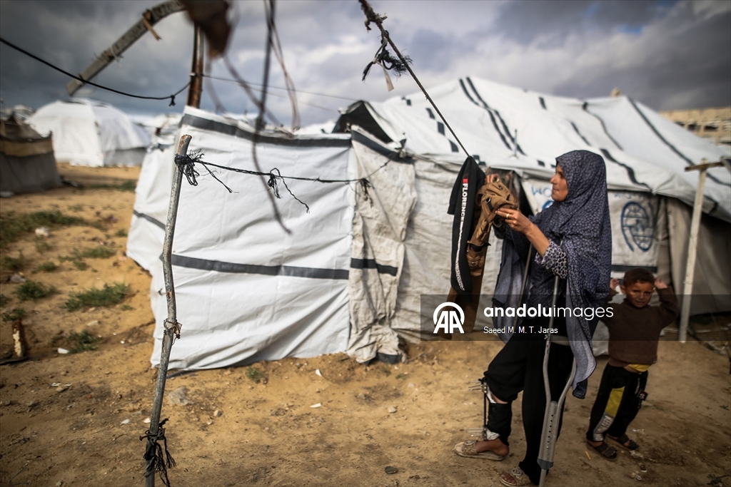 İsrail saldırısında ağır yaralanan Filistinli anne tedavi olmayı bekliyor