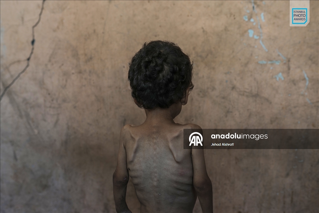 الأناضول تعلن أسماء الفائزين بـ"جوائز إسطنبول لأفضل صورة" 2026