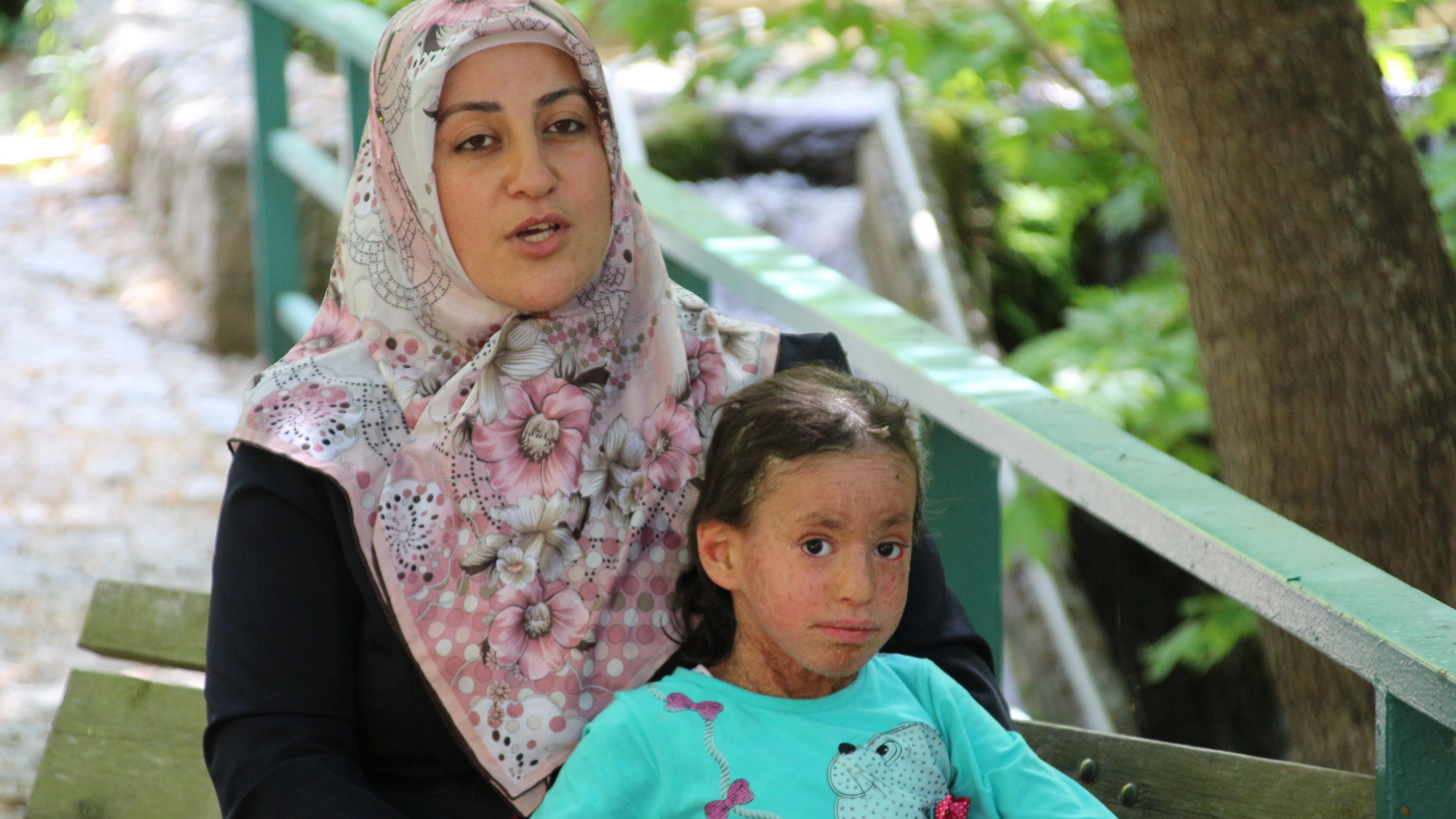 İhtiyoz – Balık Pulu Hastalığı Nedir İhtiyoz – Balık Pulu Hastalığı Nedir