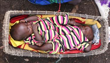 South Sudan probes birth defects in oil regions